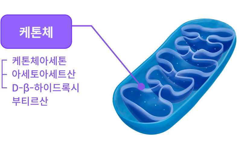 케톤체